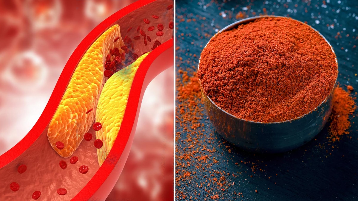 Cholestérol : Cette épice orientale, réduit le cholestérol en seulement 3 mois