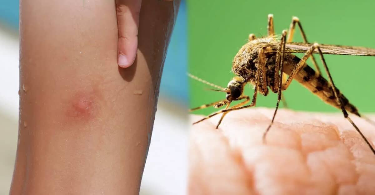 Terminé les moustiques : cette méthode simple et radicale les éloignera de votre maison tout l’été